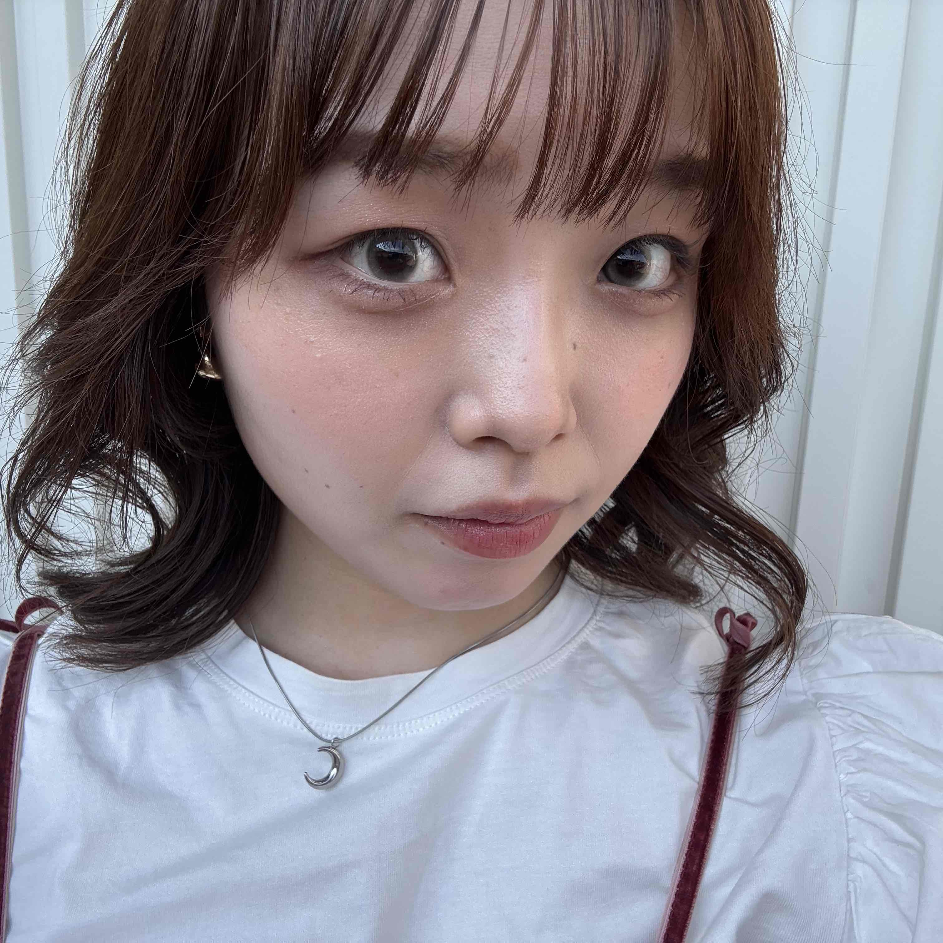 radio_img_url